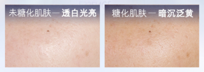 ​暗黄皮肤如何美白 别再乱用美白产品了！教你3步养出冷白皮
