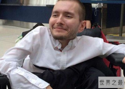 ​世界首例头部移植手术，耗时18小时花费7千万
