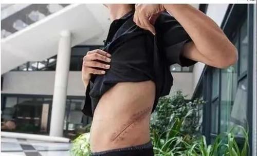 10年前，卖肾买iphone的男孩如今怎么样了5