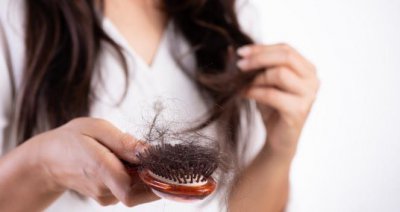 ​哪个季节是脱发高峰期 脱发了该做哪些检查