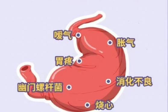 生活胃气不足该怎么办 怎么会胃气不足  1