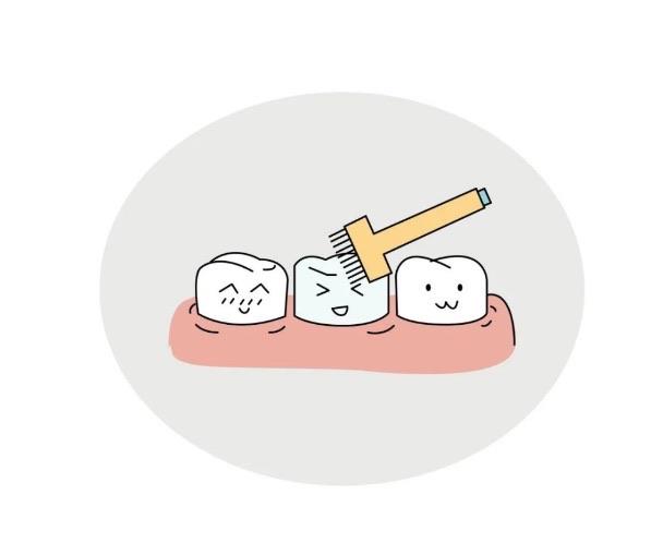 生活孩子牙齿有色素沉着会影响涂氟吗 什么时候可以做牙齿涂氟 1