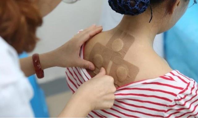 生活三伏贴有什么功效?贴三伏贴有什么注意事项? 2