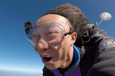 ​男人头发秃顶怎么办？