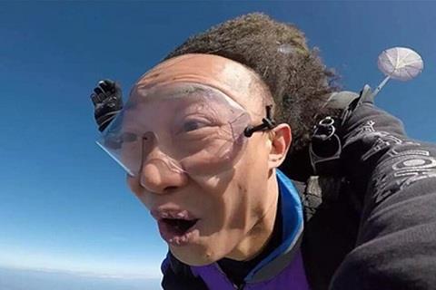 男人头发秃顶怎么办0