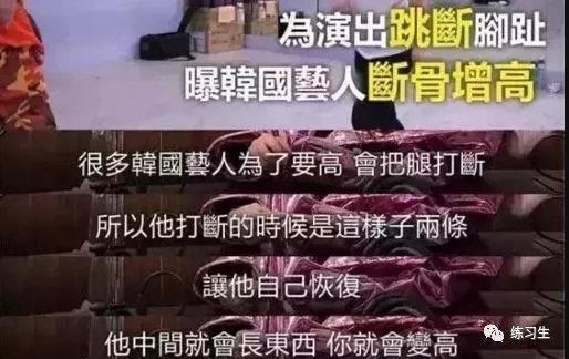 韩国练习生有多残酷？回国女孩：一天睡3小时，为了增高竟然被打断腿