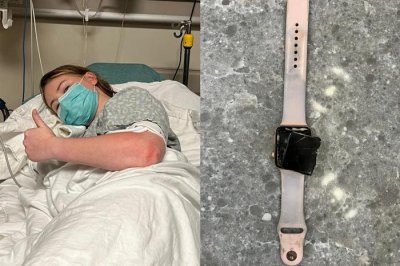 ​女大生开学第一天被闪电击中，智能手表当场爆炸，所幸奇迹存活