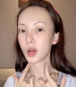 ​金晨疑整容，鼻翼现浅色小凸起，似缝针痕迹