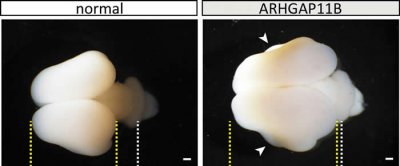 ​首次确认人类特有的“聪明基因”ARHGAP11B 进化过程中与其它灵长类区分的重