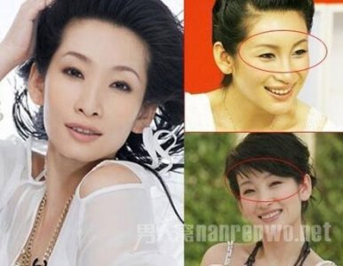 ​秦海璐整容，秦海璐儿子和女儿照片